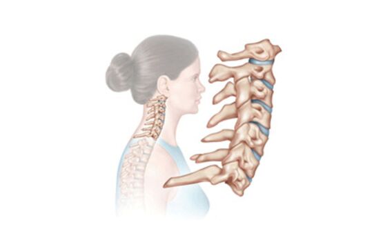 damage to the cervical spine with osteochondrosis