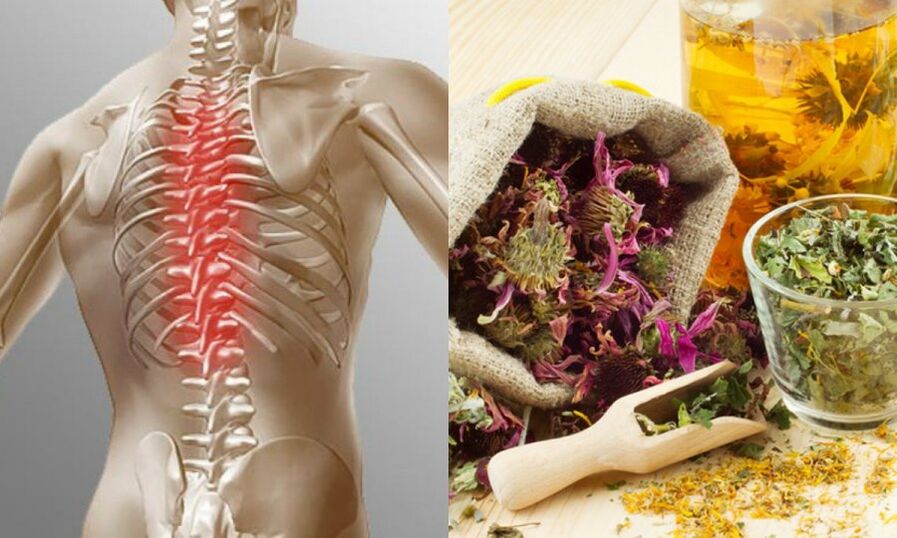 Traditional recipe - preventing the development of osteochondrosis and supporting the health of the spine