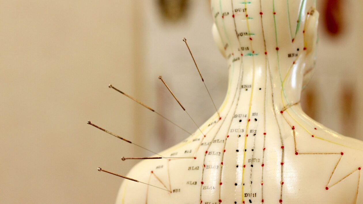 acupuncture for cervical osteochondrosis