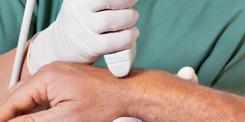 arthritis as the causes of pain in the fingertips